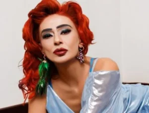 Yıldız Tilbe, saç boyasından sonra yüzünün yandığını duyurdu