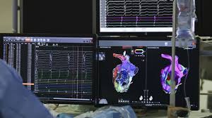 Kalp çarpıntılarında “üç boyutlu haritalama” ile kesin tedavi mümkün