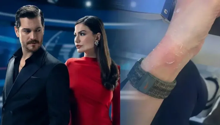 Eşref Rüya setinde kaza! Ceren Benderlioğlu’nun eli yandı